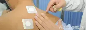 三伏贴贴敷部位图(三伏贴的贴法教程)